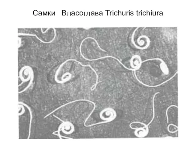 Самки Власоглава Trichuris trichiura