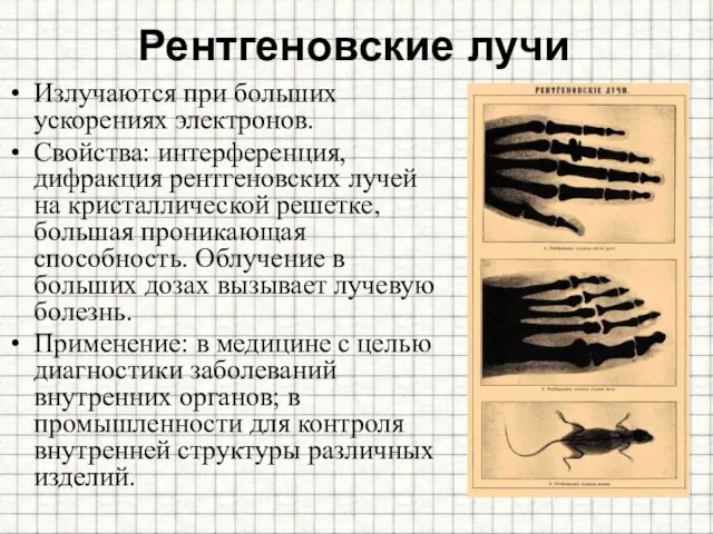 Рентгеновские лучи Излучаются при больших ускорениях электронов. Свойства: интерференция, дифракция рентгеновских