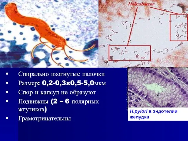 Спирально изогнутые палочки Размер: 0,2-0,3x0,5-5,0мкм Спор и капсул не образуют Подвижны
