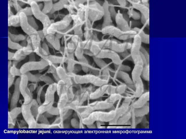 Campylobacter jejuni, сканирующая электронная микрофотограмма