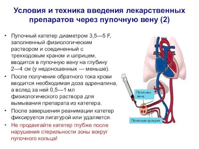 Условия и техника введения лекарственных препаратов через пупочную вену (2) Пупочный