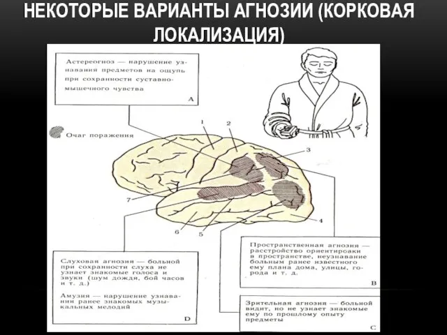 НЕКОТОРЫЕ ВАРИАНТЫ АГНОЗИИ (КОРКОВАЯ ЛОКАЛИЗАЦИЯ)