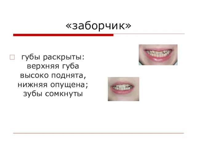 «заборчик» губы раскрыты: верхняя губа высоко поднята, нижняя опущена; зубы сомкнуты