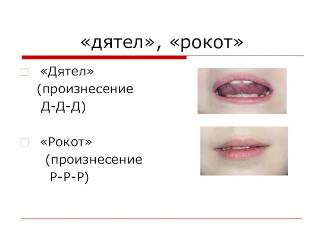 «дятел», «рокот» «Дятел» (произнесение Д-Д-Д) «Рокот» (произнесение Р-Р-Р)