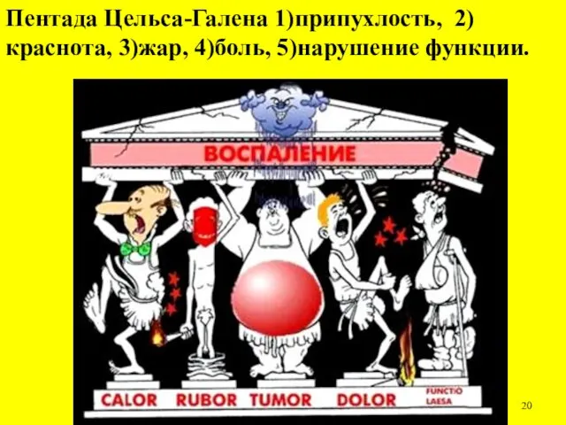 Пентада Цельса-Галена 1)припухлость, 2)краснота, 3)жар, 4)боль, 5)нарушение функции.