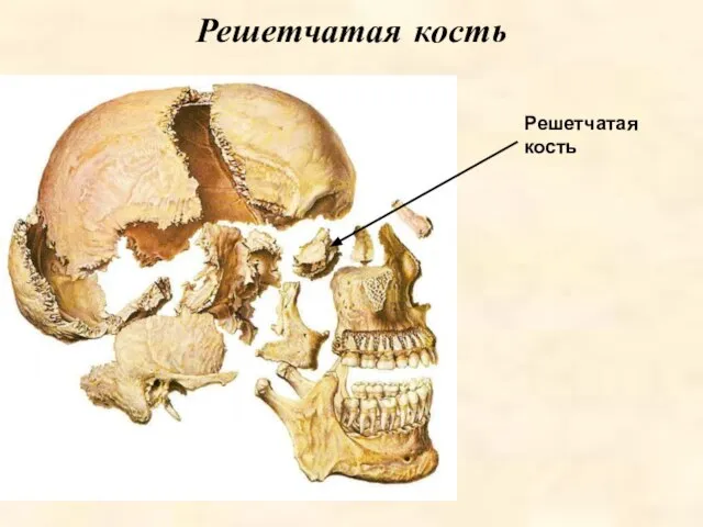 Решетчатая кость Решетчатая кость