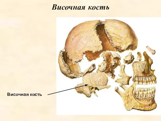 Височная кость Височная кость