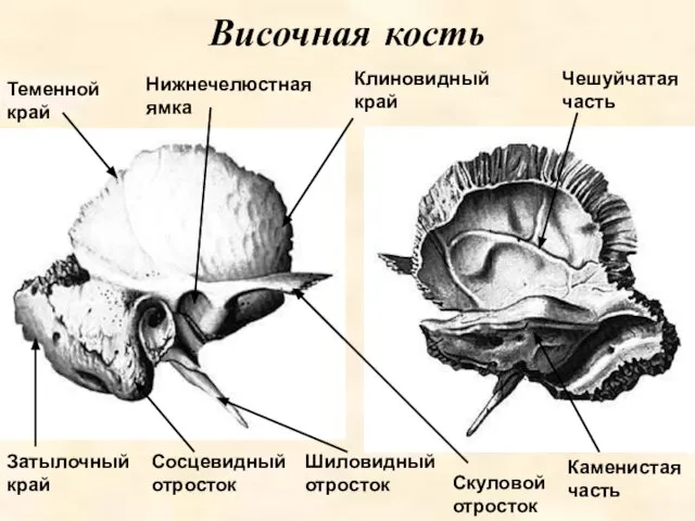 Скуловой отросток Височная кость Нижнечелюстная ямка Клиновидный край Теменной край Чешуйчатая