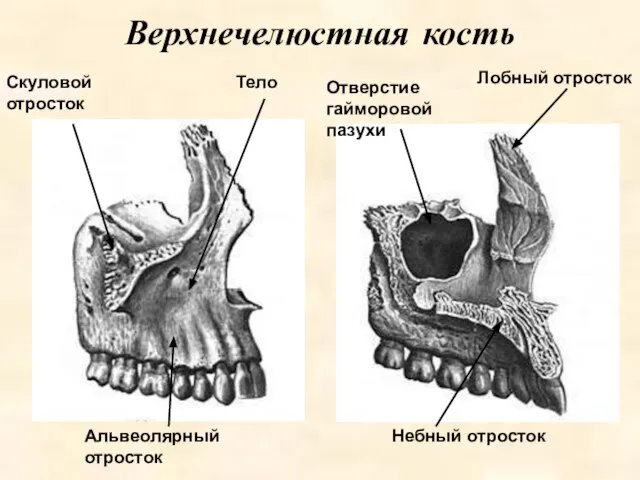 Лобный отросток Верхнечелюстная кость Небный отросток Скуловой отросток Тело Альвеолярный отросток Отверстие гайморовой пазухи