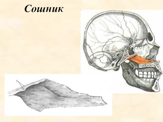 Сошник