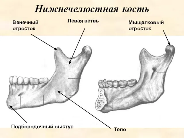 Мыщелковый отросток Нижнечелюстная кость Левая ветвь Венечный отросток Тело Подбородочный выступ