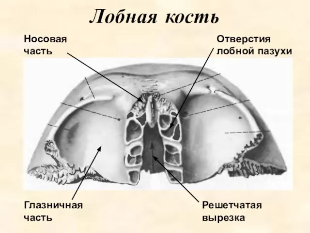 Лобная кость Глазничная часть Носовая часть Решетчатая вырезка Отверстия лобной пазухи