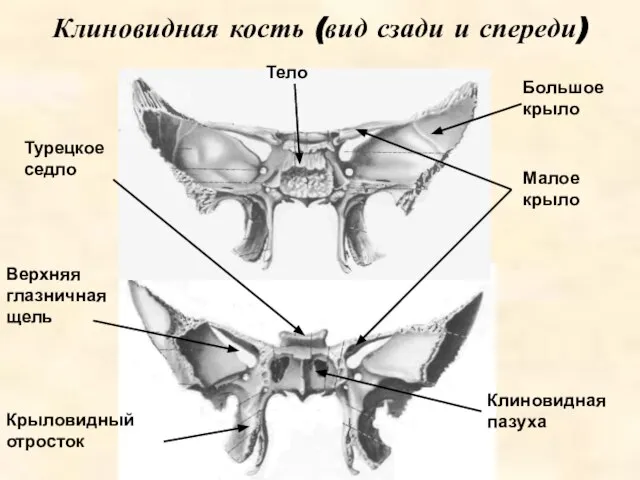 Клиновидная кость (вид сзади и спереди) Тело Клиновидная пазуха Верхняя глазничная