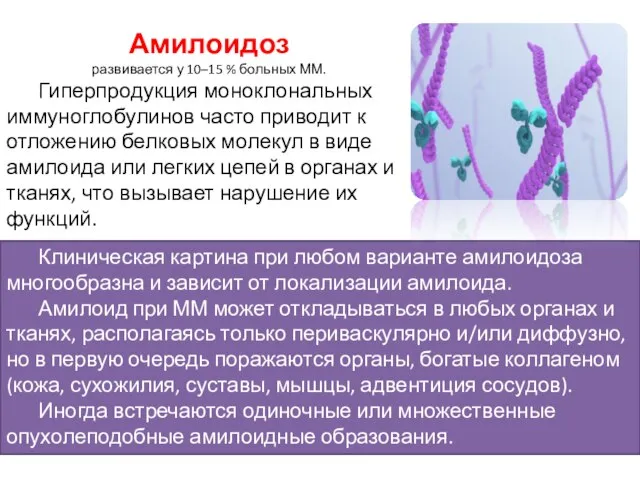 Амилоидоз развивается у 10–15 % больных ММ. Гиперпродукция моноклональных иммуноглобулинов часто