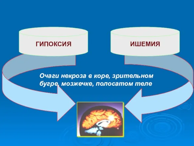 ГИПОКСИЯ ИШЕМИЯ Очаги некроза в коре, зрительном бугре, мозжечке, полосатом теле