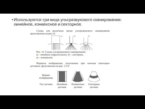 Используются три вида ультразвукового сканирования: линейное, конвексное и секторное.