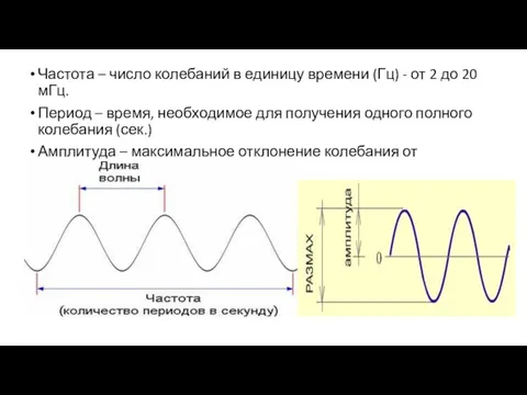 Частота – число колебаний в единицу времени (Гц) - от 2