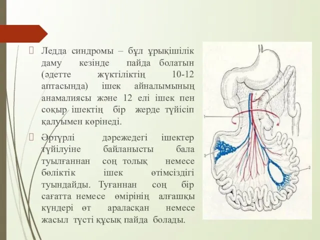 Ледда синдромы – бұл ұрықішілік даму кезінде пайда болатын (әдетте жүктіліктің