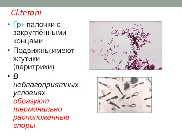 Cl.tetani Гр+ палочки с закруглёнными концами Подвижны,имеют жгутики (перитрихи) В неблагоприятных условиях образуют терминально расположенные споры