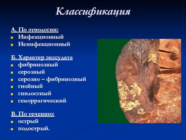 Классификация А. По этиологии: Инфекционный Неинфекционный Б. Характер экссудата фибринозный серозный