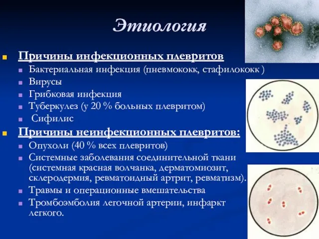 Этиология Причины инфекционных плевритов Бактериальная инфекция (пневмококк, стафилококк ) Вирусы Грибковая