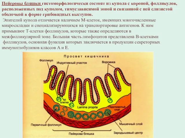 Пейеровы бляшки гистоморфологически состоят из купола с короной, фолликулов, расположенных под