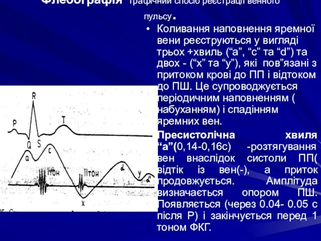 Флебографія графічний спосіб реєстрації венного пульсу. Коливання наповнення яремної вени реєструються