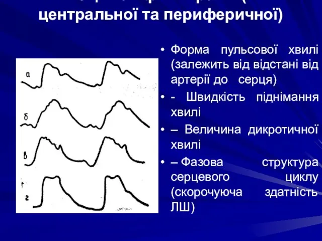 Оцінка сфігмограми ( центральної та периферичної) Форма пульсової хвилі (залежить від
