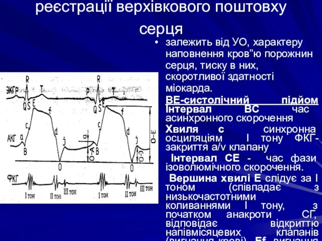 Апекскардіографія- метод реєстрації верхівкового поштовху серця залежить від УО, характеру наповнення