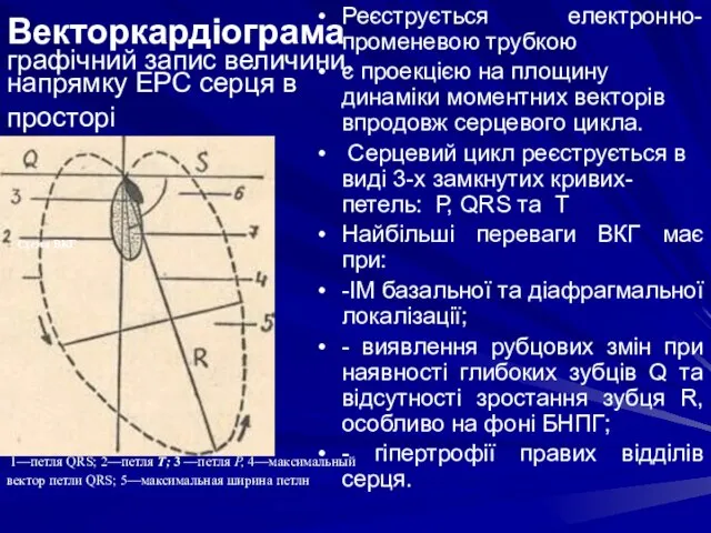 Векторкардіограма графічний запис величини, напрямку ЕРС серця в просторі Реєструється електронно-променевою