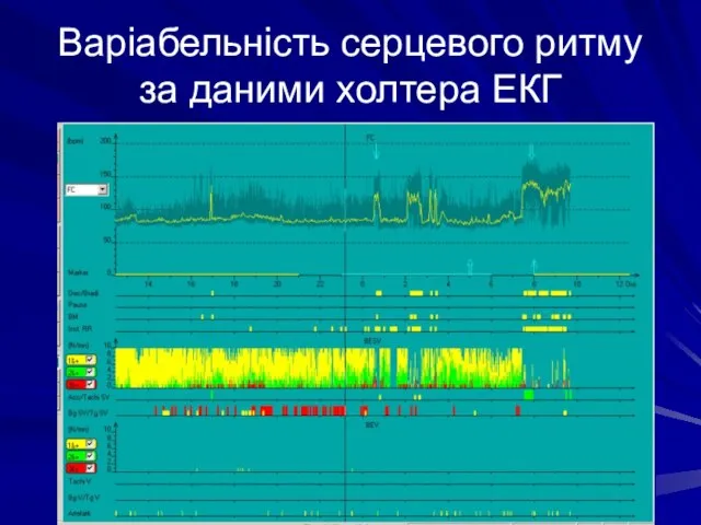 Варіабельність серцевого ритму за даними холтера ЕКГ