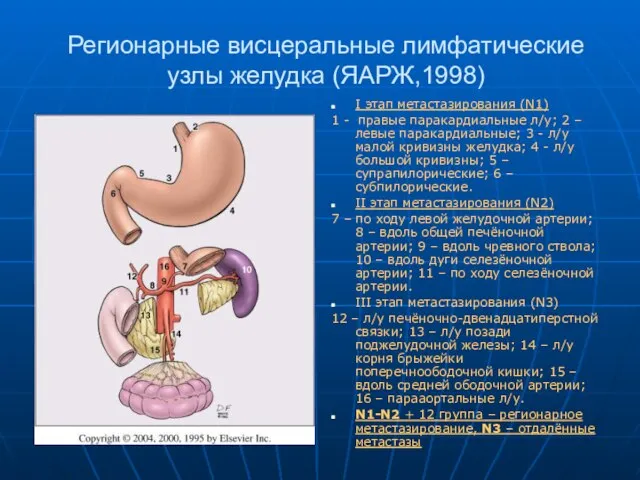 Регионарные висцеральные лимфатические узлы желудка (ЯАРЖ,1998) I этап метастазирования (N1) 1