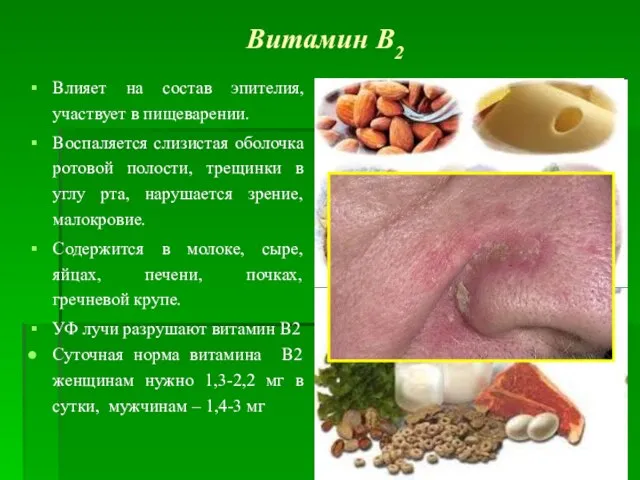 Витамин В2 Влияет на состав эпителия, участвует в пищеварении. Воспаляется слизистая