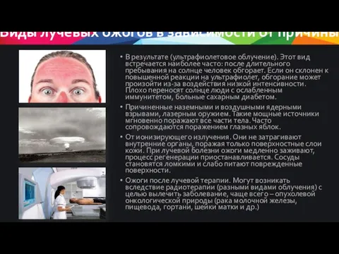 Виды лучевых ожогов в зависимости от причины В результате (ультрафиолетовое облучение).