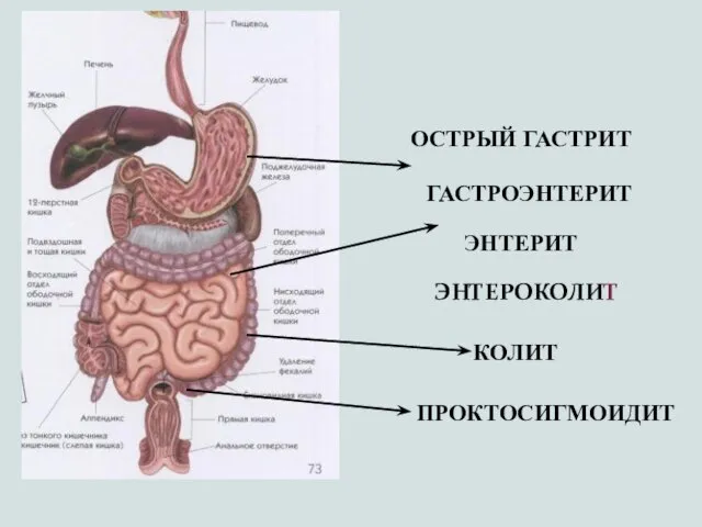 ОСТРЫЙ ГАСТРИТ ГАСТРОЭНТЕРИТ ЭНТЕРИТ ЭНТЕРОКОЛИТ КОЛИТ ПРОКТОСИГМОИДИТ