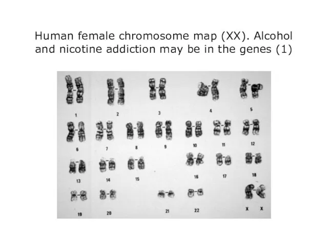 Human female chromosome map (XX). Alcohol and nicotine addiction may be in the genes (1)