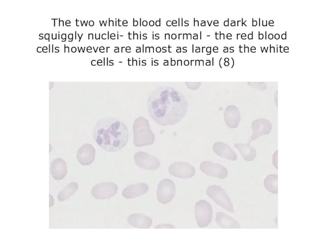 The two white blood cells have dark blue squiggly nuclei- this