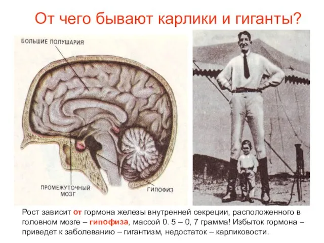 От чего бывают карлики и гиганты? Рост зависит от гормона железы