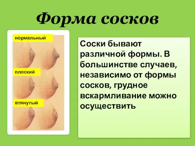 Форма сосков Соски бывают различной формы. В большинстве случаев, независимо от