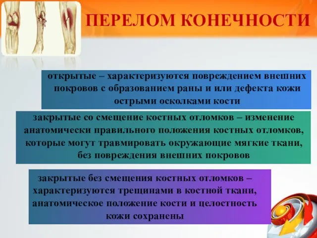 закрытые без смещения костных отломков – характеризуются трещинами в костной ткани,