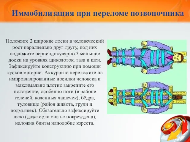 Иммобилизация при переломе позвоночника Положите 2 широкие доски в человеческий рост