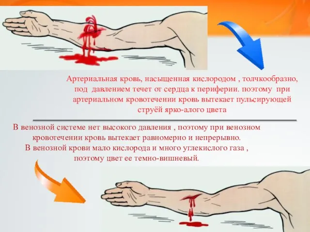 В венозной системе нет высокого давления , поэтому при венозном кровотечении