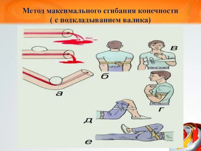 Метод максимального сгибания конечности ( с подкладыванием валика)