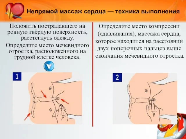 Непрямой массаж сердца — техника выполнения Положить пострадавшего на ровную твёрдую