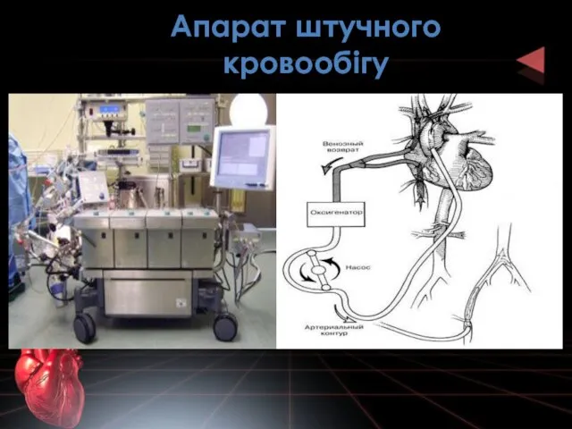 Апарат штучного кровообігу