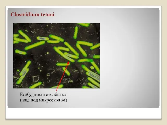 Clostridium tetani Возбудители столбняка ( вид под микроскопом)