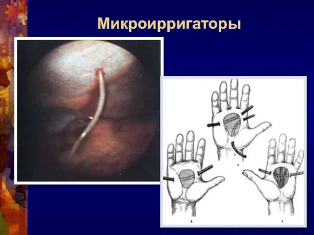 Микроирригаторы