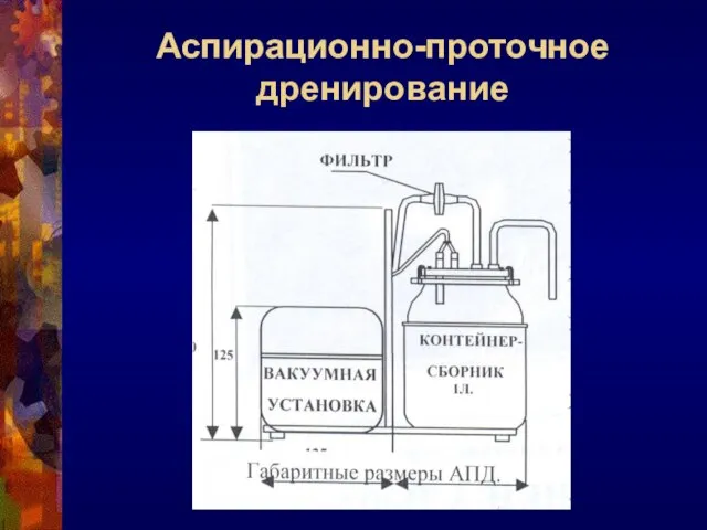 Аспирационно-проточное дренирование