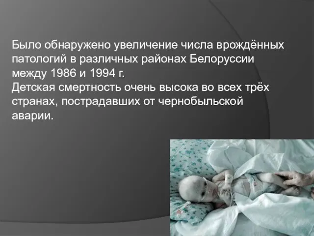 Было обнаружено увеличение числа врождённых патологий в различных районах Белоруссии между