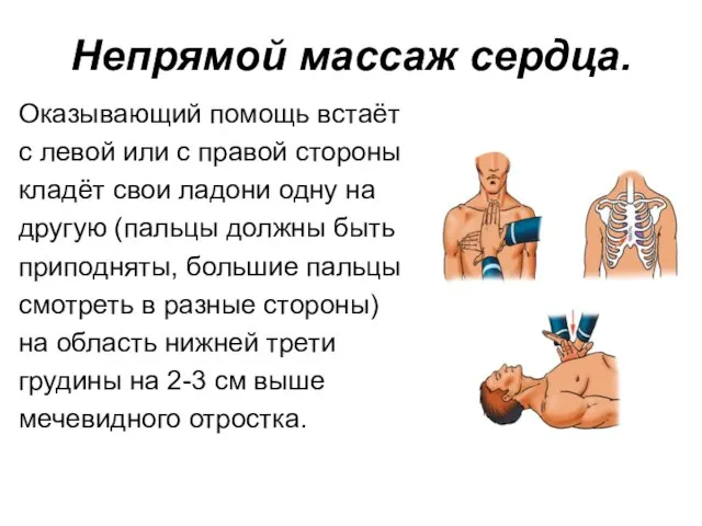 Непрямой массаж сердца. Оказывающий помощь встаёт с левой или с правой